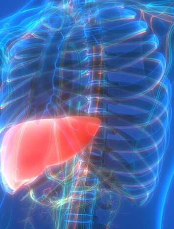 Non alcoholic fatty liver disease